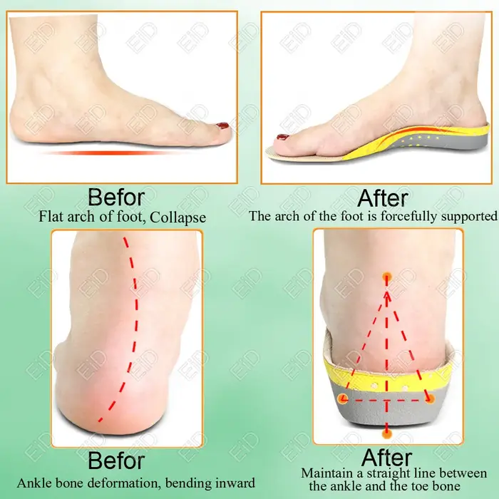 Semelles orthopédiques en gel de qualité supérieure unisexe, pied plat 4WD, semelle de santé pour ch