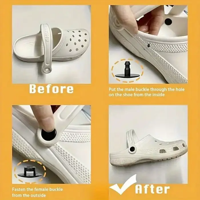 100 pièces de rivets de chaussures en plastique-accessoire de réparation rapide pour sabots en mousse et chaussures à enfiler-boutons de fixation durables-noir
